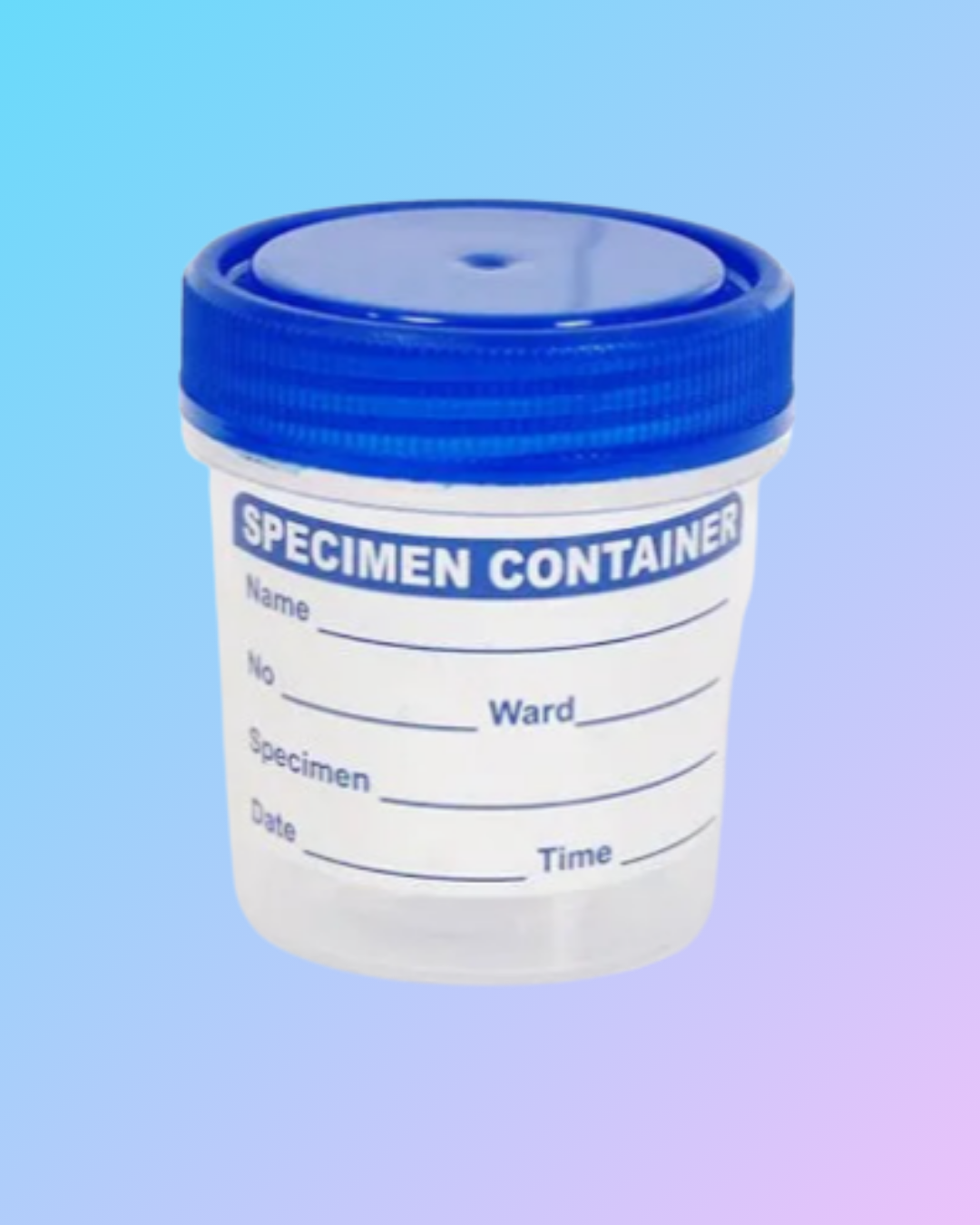 Sterile Urine Sample Container for Laboratory Use